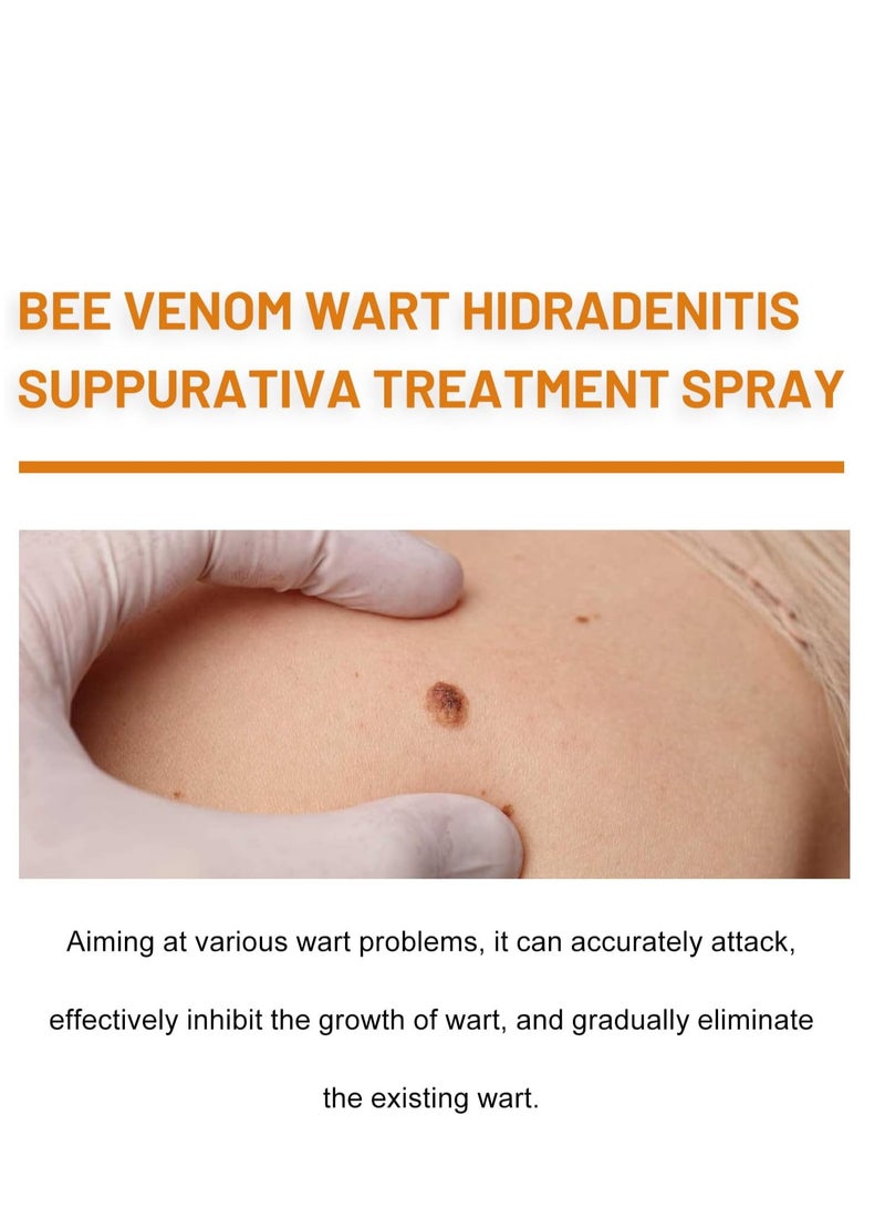 ximonth Bee Venom Wart Removal Spray, Bee Venom Wart Removal Solution, Wart Removal Freezer, Wart Removal Spray, Skin Tag Removal, Painless Removal of Skin Tags and Moles 20ml - Image 3