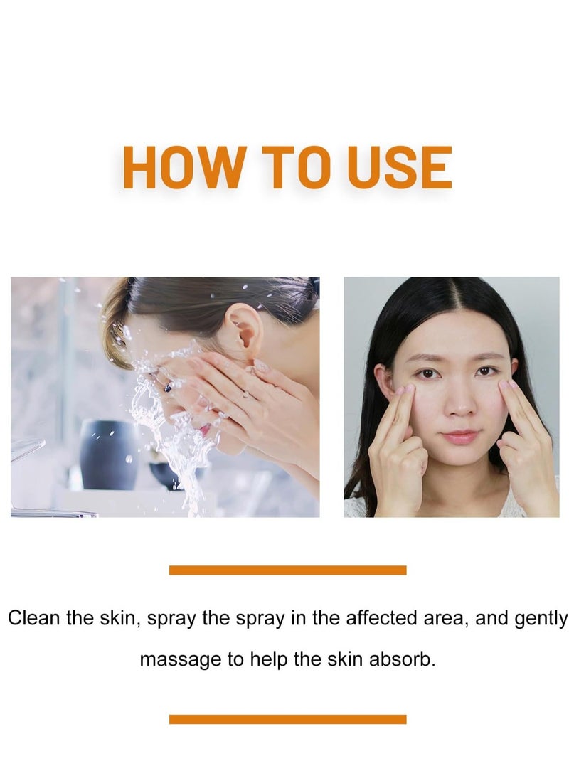 ximonth Bee Venom Wart Removal Spray, Bee Venom Wart Removal Solution, Wart Removal Freezer, Wart Removal Spray, Skin Tag Removal, Painless Removal of Skin Tags and Moles 20ml - Image 5