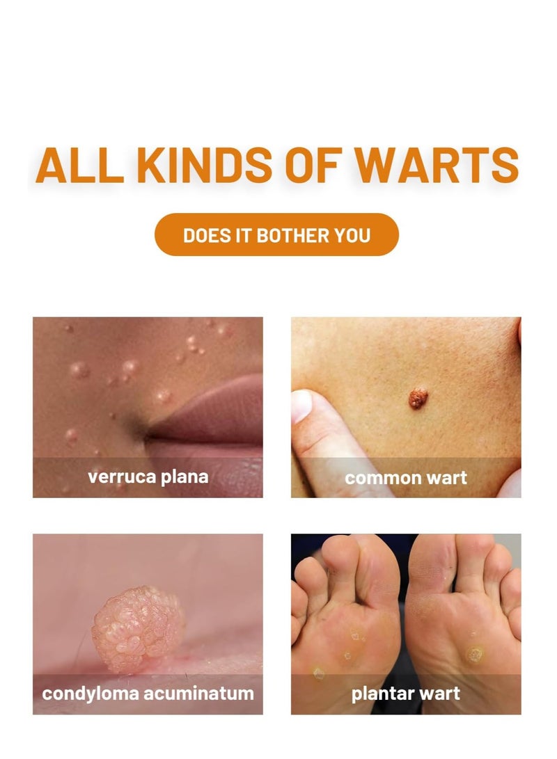 ximonth Bee Venom Wart Removal Spray, Bee Venom Wart Removal Solution, Wart Removal Freezer, Wart Removal Spray, Skin Tag Removal, Painless Removal of Skin Tags and Moles 20ml - Image 4