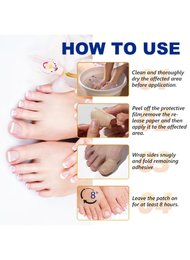 ATRJSZ 32 PCS Fungal Nail Patches for Broken Damaged Split Nails,Toenail Treatment Extra Strength,Nail Repair for Damaged Nails, Nails Care Supplies, Restore Discoloration and Thickness - Image 3