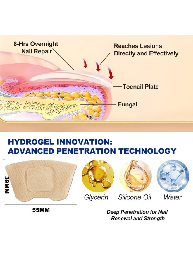 ATRJSZ 32 PCS Fungal Nail Patches for Broken Damaged Split Nails,Toenail Treatment Extra Strength,Nail Repair for Damaged Nails, Nails Care Supplies, Restore Discoloration and Thickness - Image 5