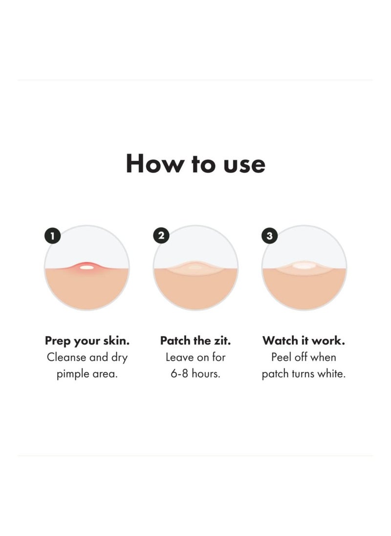 Hero - Hero's Mighty Patch, Original Powerful Hydrocolloid Acne Pimple Patches for Effective Zit and Blemish Coverage - 36 Count for Clear and Smooth Skin. - Image 1