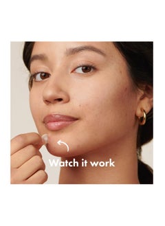 Hero Hero's Mighty Patch, Original Powerful Hydrocolloid Acne Pimple Patches for Effective Zit and Blemish Coverage - 36 Count for Clear and Smooth Skin.  - Image 5