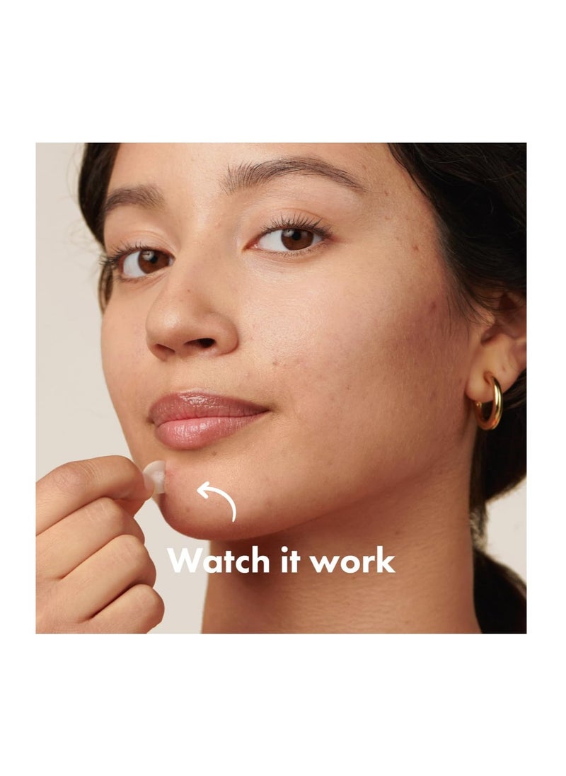 Hero - Hero's Mighty Patch, Original Powerful Hydrocolloid Acne Pimple Patches for Effective Zit and Blemish Coverage - 36 Count for Clear and Smooth Skin. - Image 1