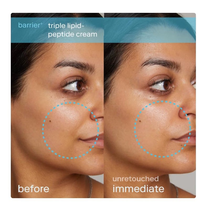 Skinfix كريم سكين فيكس ثلاثي الدهون والببتيد - 1.7 أونصة - مرطب وجه غني مع حمض الهيالورونيك - يرطب ويستعيد البشرة الجافة والحساسة - غير كوميدوغينيك، خالي من العطور، نباتي، خالي من القسوة - Image 4
