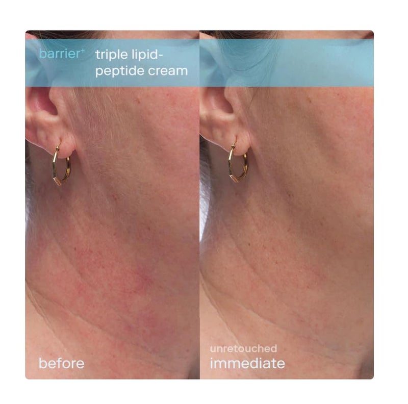 Skinfix كريم سكين فيكس ثلاثي الدهون والببتيد - 1.7 أونصة - مرطب وجه غني مع حمض الهيالورونيك - يرطب ويستعيد البشرة الجافة والحساسة - غير كوميدوغينيك، خالي من العطور، نباتي، خالي من القسوة - Image 5