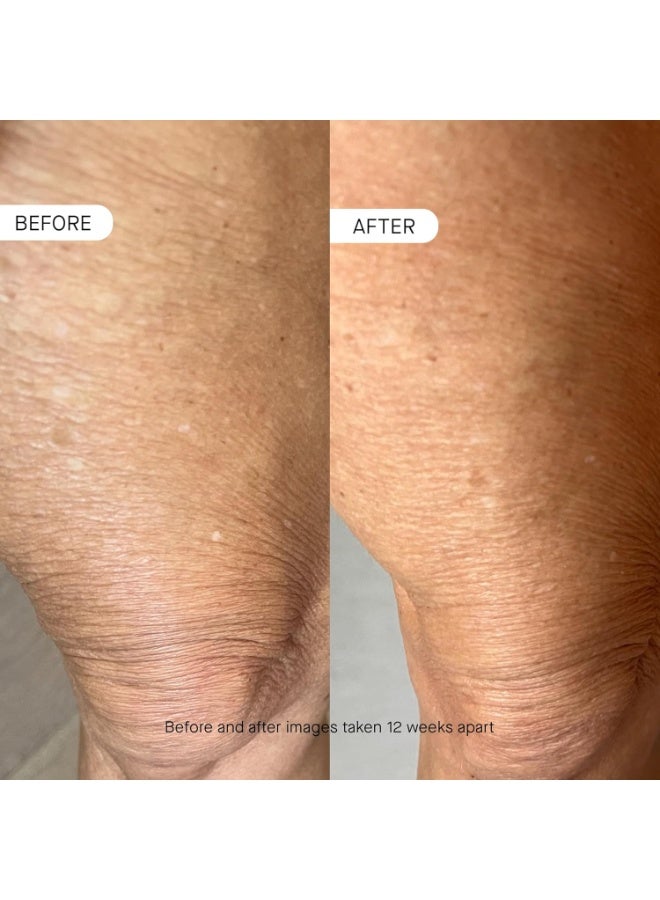 OneSkin BODY OS-01 Peptide Topical Supplement & Skin Longevity Age Reversal Moisturizer | Safe for Sensitive Skin, Fragrance-Free - Image 4