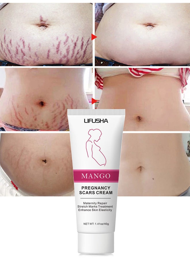LIFUSHA Mango Stretch Marks and Scar Cream Stretch Marks and Scar Removal Cream for Pregnancy Stretch Marks Scar Belly Creams for Wrinkles Obesity Stretch Mark Moisturizing Remove Marks 40g - Image 3