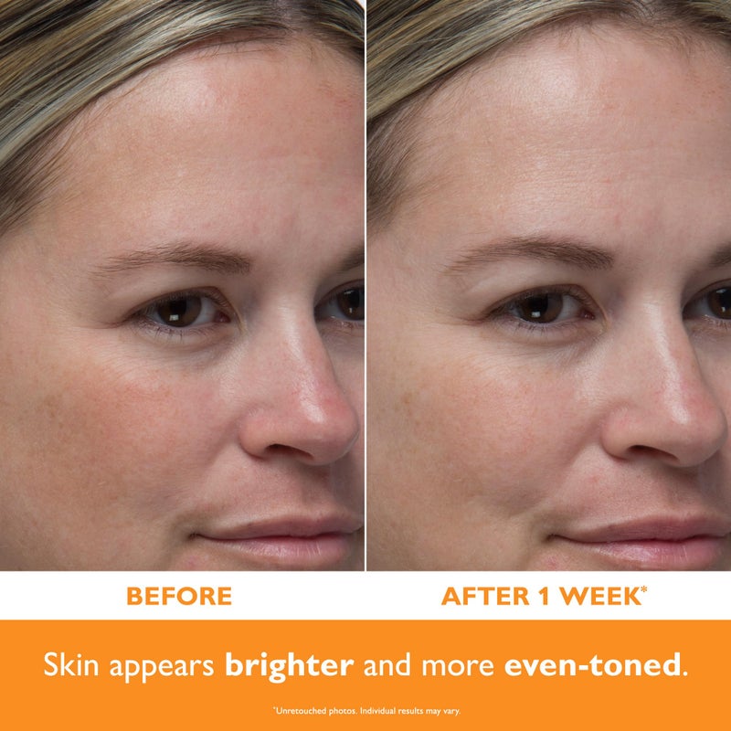 Peter Thomas Roth | Potent-Câ„¢ Power Serum - Image 3