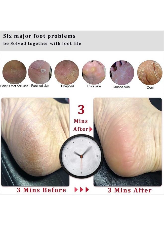 Kinepi - Foot File Callus Remover Foot Scrubber,Professional Pedicure Foot Rasp Removes Cracked Heels,Dead Skin,Corn,Hard Skin,Pumice Stone for Feet Scraper File Brush Tools for Wet and Dry Feet - Image 1
