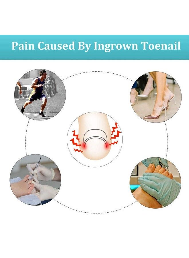 Mudder 122 Pieces Ingrown Toenail Tool Set Include Ingrown Toenail File And Lifter 60 Pieces Elastic Patch Curved Toenails Brace Stickers And 60 Pieces Ingrown Toenail Correction Stickers  - Image 3