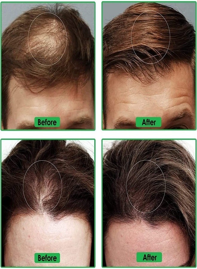 FEG - Hair Growth Spray 50ml - Image 1