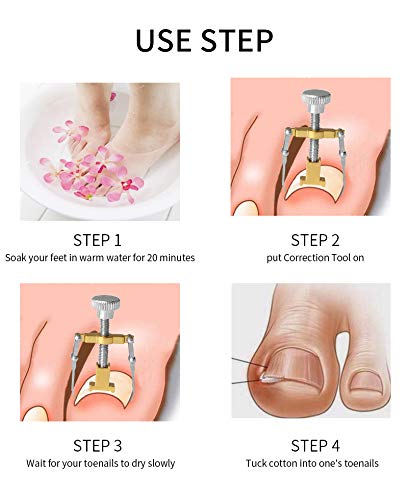 Vitalogy - Ingrown Toenail Correction Tool with CASE | Feet Toe Nail Pedicure Corrector Lifter Fixer Toe Nail Straightener Tool & Helps Treatment for Nail Fungus | Toe Nail Correction Tool - GOLD - Image 4