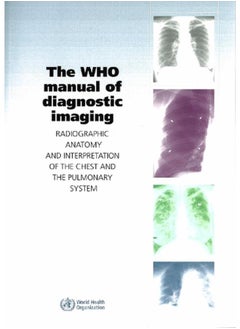 The WHO Manual of Diagnostic Imaging: Radiographic Anatomy and Interpretation of the Chest