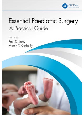 Essential Paediatric Surgery: A Practical Guide - pzsku/Z46F0187698E5C4E6BB04Z/45/1749824131/add17926-838a-4e08-81de-c797a2d8b0f8