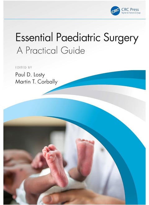 Essential Paediatric Surgery: A Practical Guide
