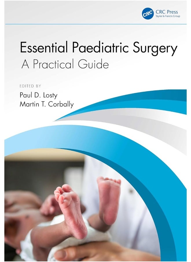 Essential Paediatric Surgery: A Practical Guide