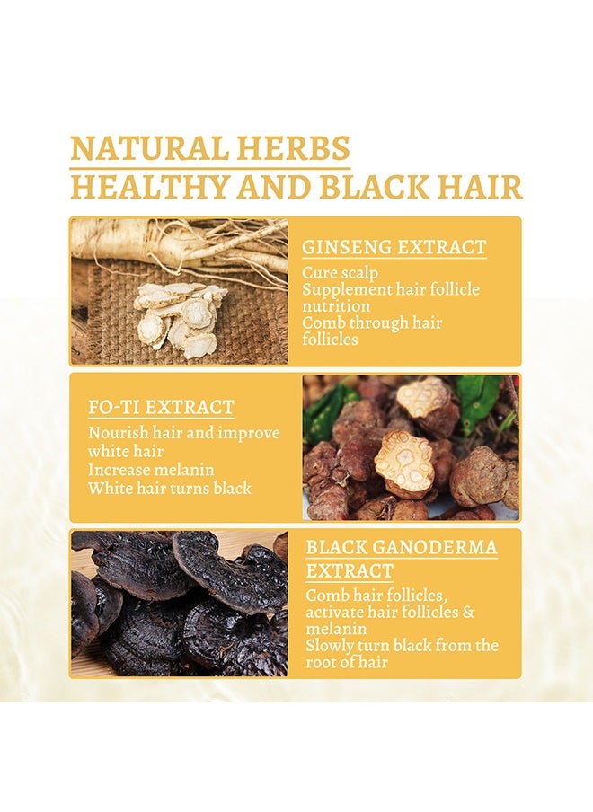 SOUTH MOON Ganoderma Nutrient Essence 30ml,Has The Effect Of Supplementing Hair Follicles, Repairing Hair Damage, Activating Hair Follicles And Melanin, And Obtaining Shiny Black Hair  - Image 2