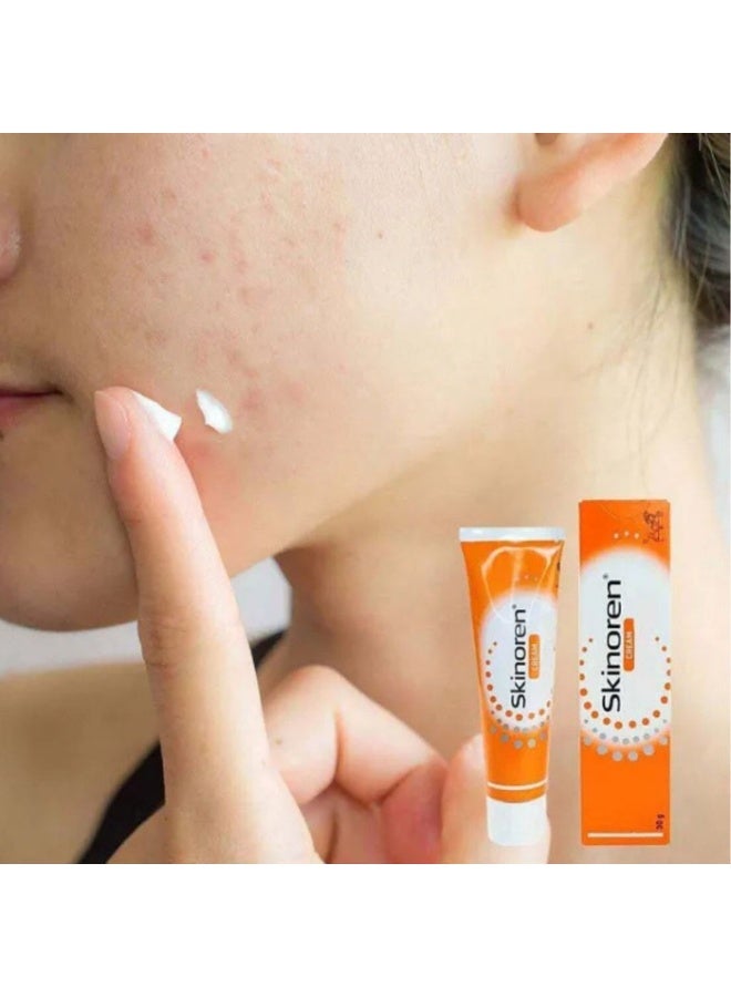 Skinoren Acne Treatment Cream 30g | Azelaic Acid Formula for Pimples, Acne Marks & Clearer-Looking Skin - Image 5