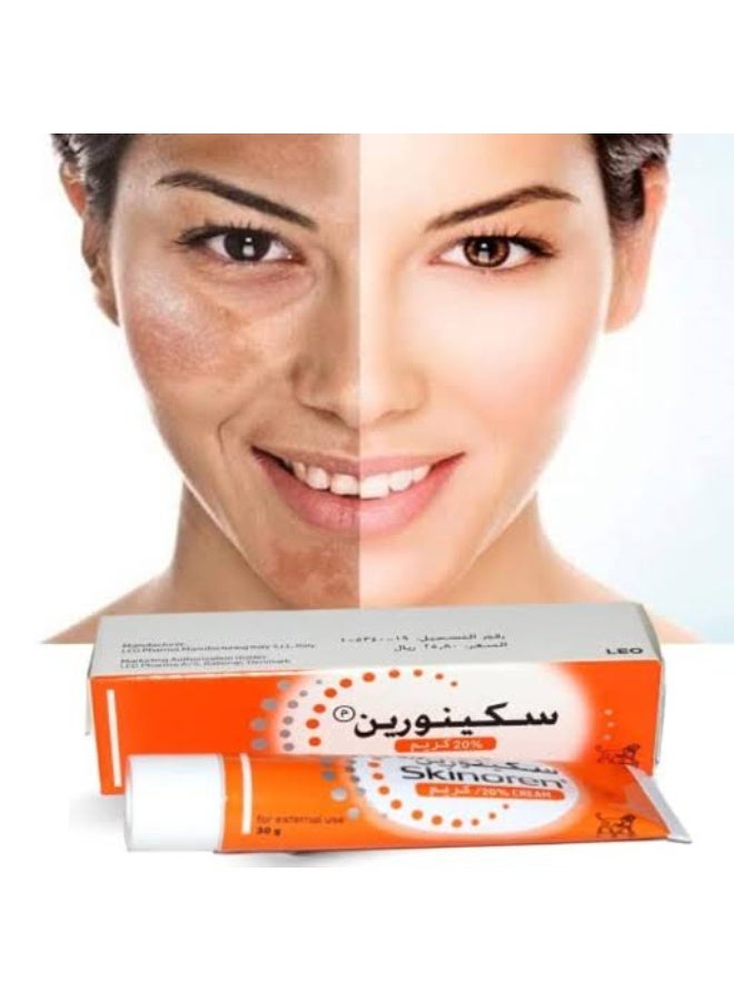 Skinoren Acne Treatment Cream 30g | Azelaic Acid Formula for Pimples, Acne Marks & Clearer-Looking Skin - Image 3
