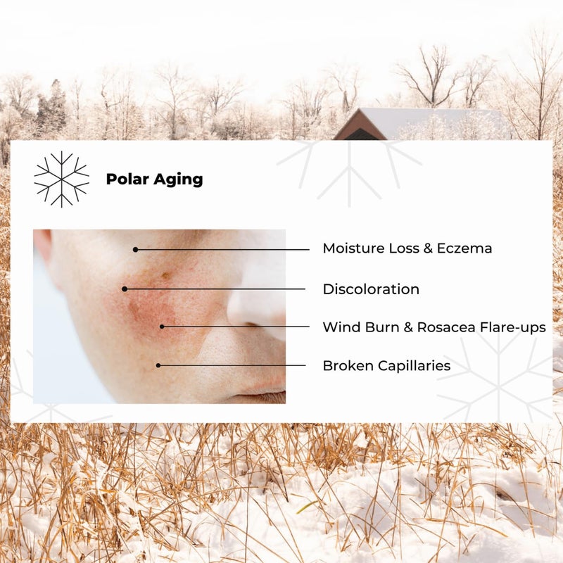 Pour Moi Polar Retinol Day Cream â€“ Intense Moisturizer with Shea Butter & Hyaluronic Acid â€¢ Climate-SmartÂ® Skincare for Cold Dry Winter â€¢ Barrier Strengthening â€¢ 30ml - Image 2