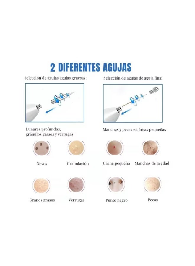 Professional LED Intensive Plasma Mole Removal Pen - 9-Speed ​​Intelligent Frequency Adjustment Spot Fading Device, Lightweight and Portable Skin Growth Remover, Adult Full Body Blemish Repair Tool (1-Pack) - Image 2
