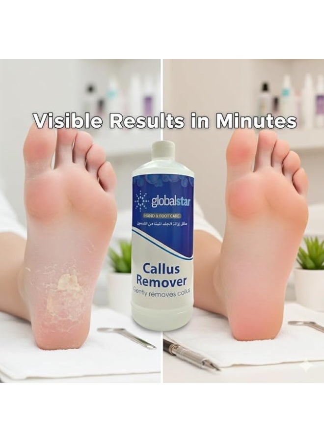 globalstar Callus Remover - 1000ml - Image 2