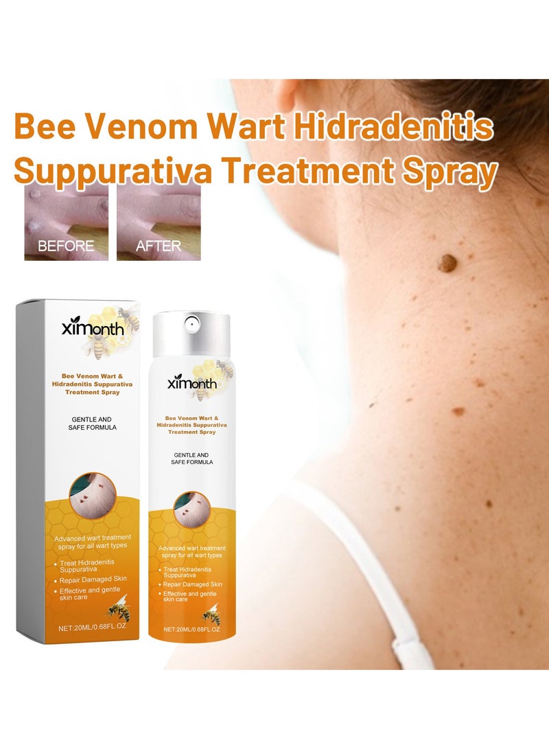 ximonth 3-pack Bee Venom Wart Removal Cream, Improves Pimples, Moles and Repairs Skin 20ml*3 - Image 2