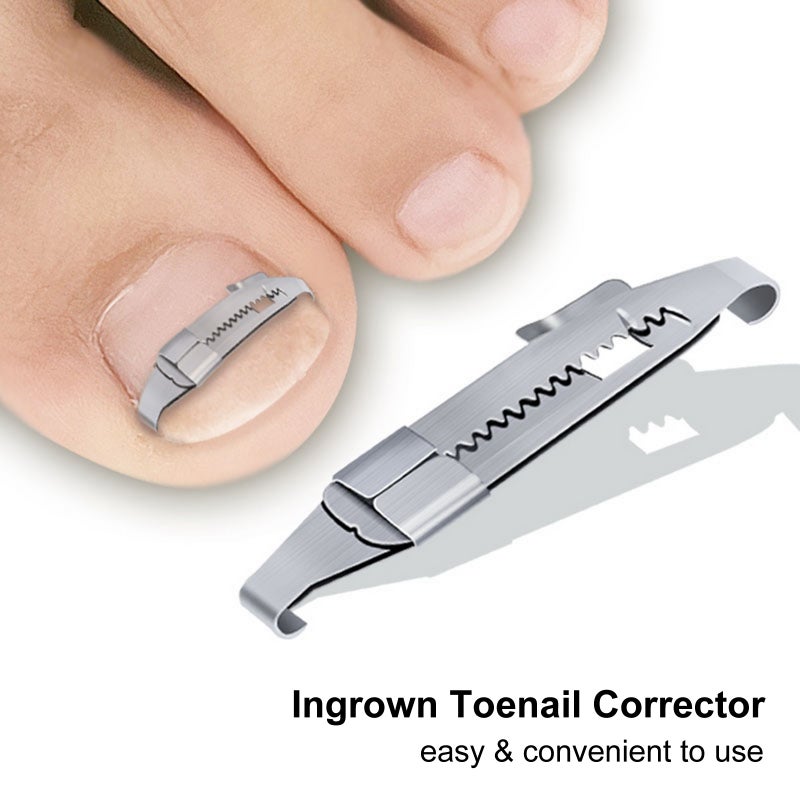 2pcs Ingrown Toenail Corrector Toenail Correction Treatment Tool Foot Nail Care Tool Orthotic Nail Corrector Pedicure Tool - Image 4
