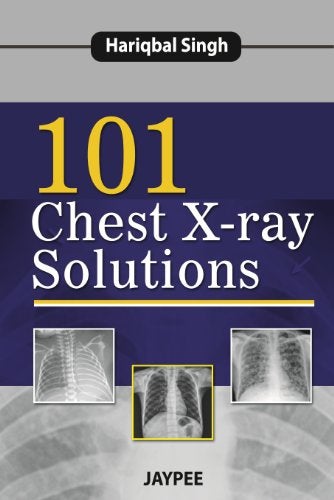 101 Chest X-Ray Solutions Singh Hariqbal 
