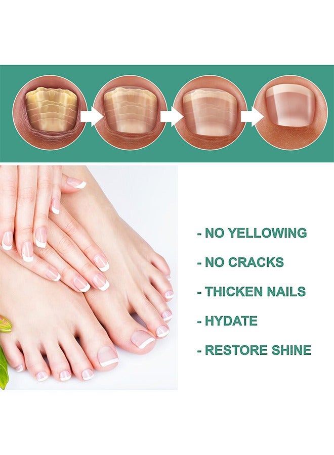 EELHOE Herbaceous Nail Treatment Essence - Fungal Nail Treatment Solution | Nail Repair and Strengthening | Thickening and Soft Nail Restoration Serum - Image 4