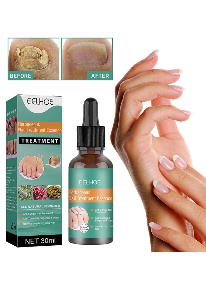 EELHOE Herbaceous Nail Treatment Essence - Fungal Nail Treatment Solution | Nail Repair and Strengthening | Thickening and Soft Nail Restoration Serum - Image 1