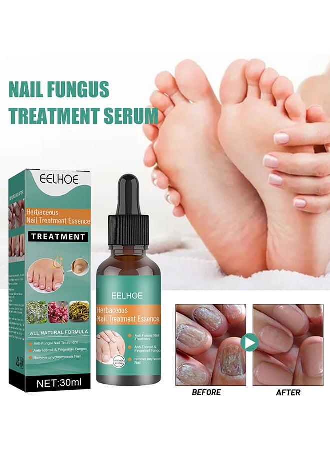 EELHOE Herbaceous Nail Treatment Essence - Fungal Nail Treatment Solution | Nail Repair and Strengthening | Thickening and Soft Nail Restoration Serum - Image 2
