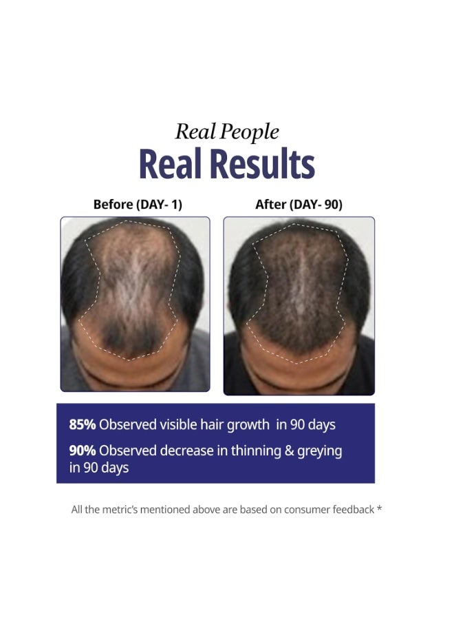 Reginald Men Athena- All in one Hair Serum | Hair Fall Control & Follicle Boost with 12 Actives | Advanced Hair Growth Serum For Scalp | Controls HairFall & Boosts New Hair Growth | For Men | 60ml - Image 3