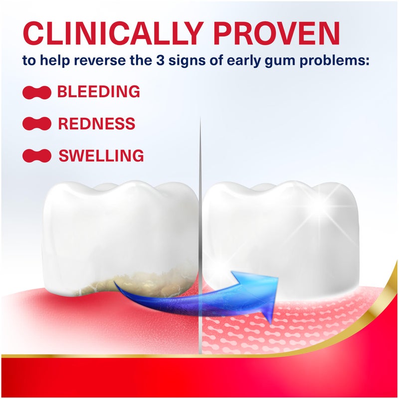 Parodontax Active Gum Repair Toothpaste, Toothpaste To Help Reverse Signs Of Early Disease For Health, Fresh Mint Flavored - 3.4 Oz x 3 - Image 2