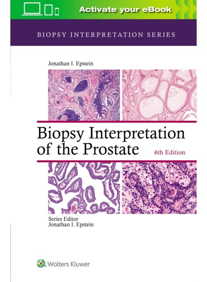 Biopsy Interpretation of the Prostate - Hardback