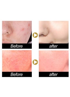 EELHOE Advanced Snail 92 All In One Cream,Moisturizing Acne Scar Removal Cream , Anti-Aging & Wrinkle Removal and Whitening, Improve Skin Nourishing Collagen Essence Cream For Improve Damaged Skin 100ml  - Image 4