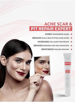 Brinton AcneScar Advanced Gel (15g) for Acne Scars and Pits | Men & Women | Help to Reduce Old & New Scar | Reduces Pigmentation | Fights Blackheads | For All Skin Types  - Image 5