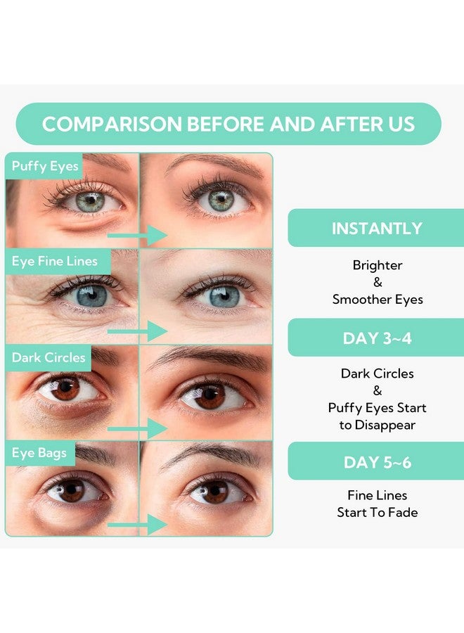 LANBENA 8X Hyaluronic Acid Under Eye Patches(30 Pairs) -Cooling Eye Masks for Deep Moisturizing, with Ectoin Niacinamide Hydra-Gel Collagen, Puffy Eyes Treatment, Fine Lines & Wrinkles Reduce - Image 4