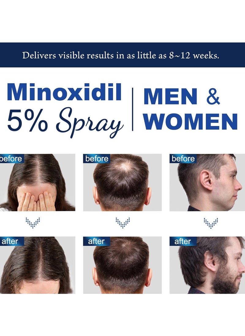 HOEGOA Minoxidil 5% for Men (120 ML), Advanced Minoxidil Spray with Provitamin B5 and Castor Seed Extract, Minoxidil Extract Serum for Hair Loss, Beard Restoration  - Image 3