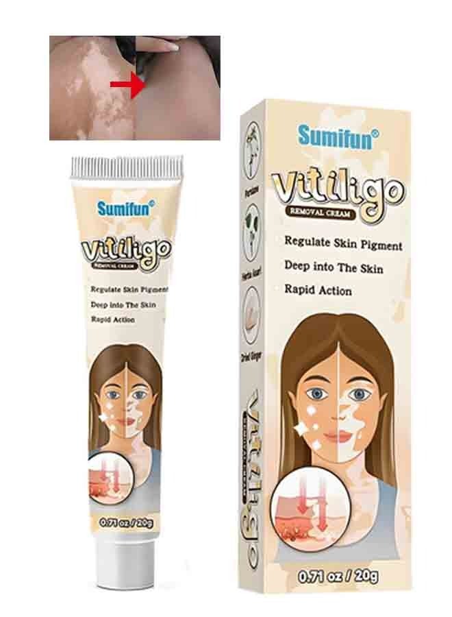 سوميفون كريم دعم بشرة البهاق - يعزز مظهر لون البشرة المتساوي والراحة (20 جرام) - Image 1