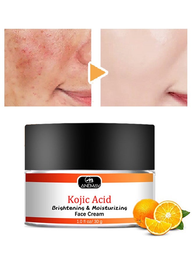 Kojic Acid Face Cream 30g, Moisturizing Brightening the Skin, Lightweight Non-Greasy Deep Penetration Anti-Aging，Spots Or Acne Scars In A Effective Way - pzsku/Z47633EF7BCB58814567DZ/45/_/1717301283/2b7b4d5f-d641-4775-ba61-6250ff926b40