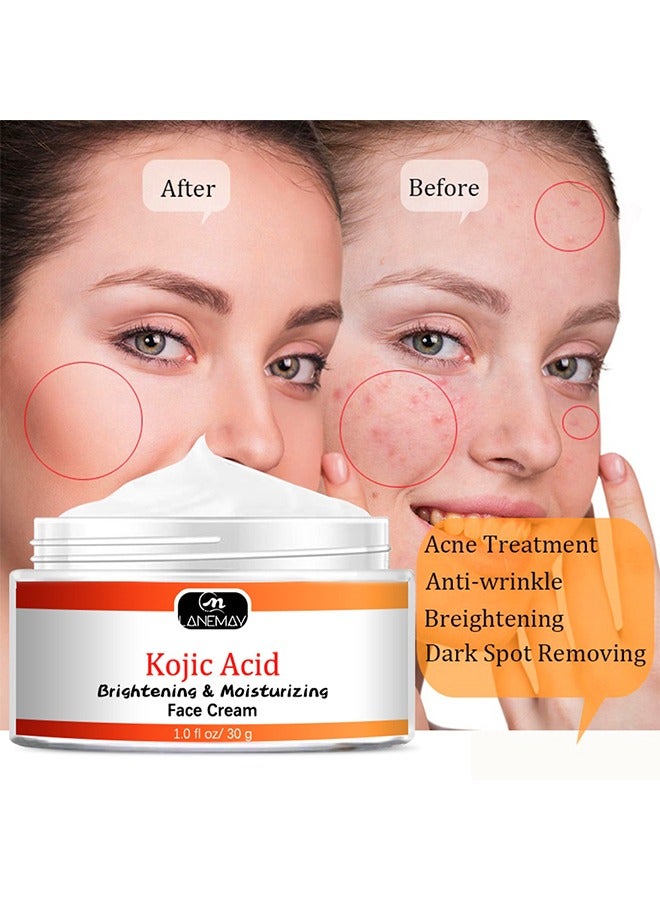 لينماي كريم الوجه بحمض كوجيك 30 جم ، ترطيب وتفتيح البشرة ، اختراق عميق خفيف الوزن غير دهني مضاد للشيخوخة ، بقع أو ندبات حب الشباب بطريقة فعالة - Image 3