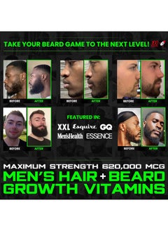 Bbs Beard Growth & Hair Growth Vitamins For Men Maximum Strength 620000Mcg Biotin Collagen Msm Keratin Bamboo Extract Multivitamin Gummies (Made By Best Beard Stuff Usa) - pzsku/Z477D8FC02AEA43CEB451Z/45/_/1695145355/3afb46d8-8581-43d7-94ba-eb80531357ff