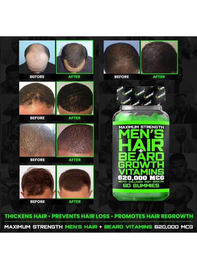 BBS BEST BEARD STUFF - Bbs Beard Growth & Hair Growth Vitamins For Men Maximum Strength 620000Mcg Biotin Collagen Msm Keratin Bamboo Extract Multivitamin Gummies (Made By Best Beard Stuff Usa) - Image 1