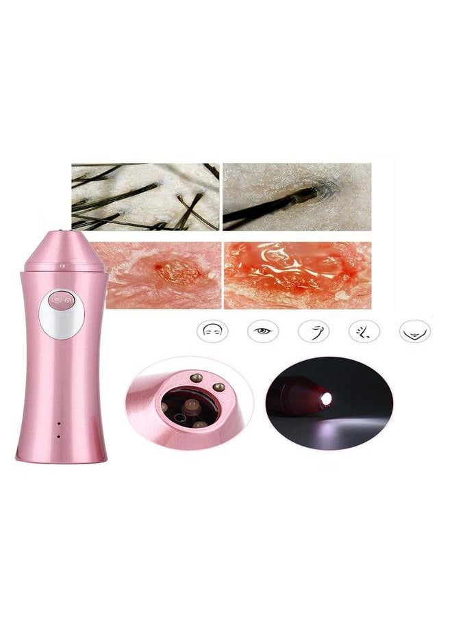 Thoraya HD Wifi Wireless Scalp Hair Microscope Detector Analyzer Skin Care Tool  - Image 5