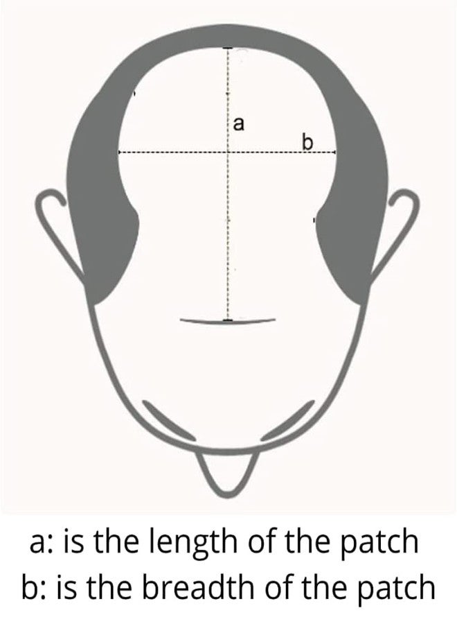 EUPHORIA® 8x6 Original FINE R MONO Hair Patch for Men 100% Natural Brown Human Hair Wig Install with Hair Toupee Tape, Clips or Glue - Image 5