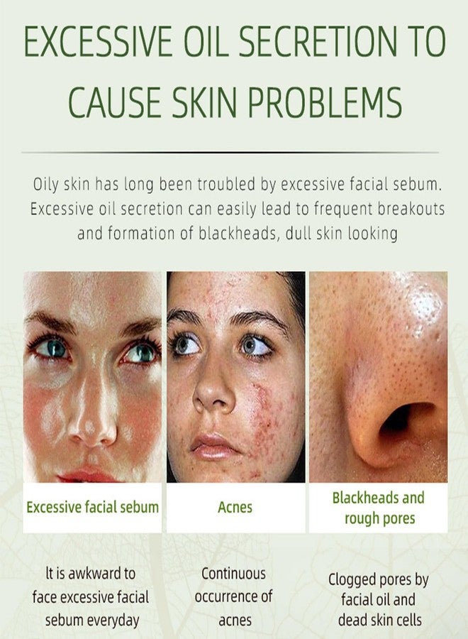 Grospe Acne Removing Face Cream,Natural Ingredients Professionally Remove Acne Marks,For Teens & Adults Anti-acne Moisturizer Pimple Cream - Image 2