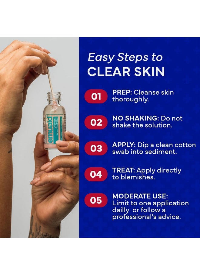 Emuaid EMUAID Overnight Acne Treatment | Gentle, Fast-Acting Solution for Adults & Teens with Salicylic Acid | Clears Stubborn Pimples, Cystic Acne, Blackheads, Rosacea & Hormonal Breakouts | 1oz  - Image 5