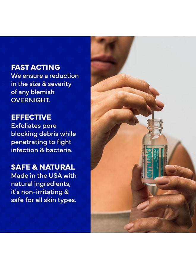 Emuaid EMUAID Overnight Acne Treatment | Gentle, Fast-Acting Solution for Adults & Teens with Salicylic Acid | Clears Stubborn Pimples, Cystic Acne, Blackheads, Rosacea & Hormonal Breakouts | 1oz  - Image 3